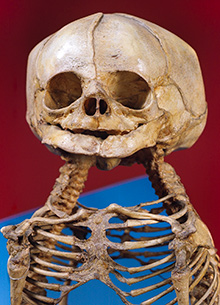 Skeleton